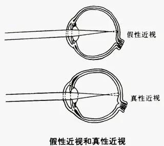 【组图】父母损眼8重“罪”，孩子眼睛坏了却不知！！