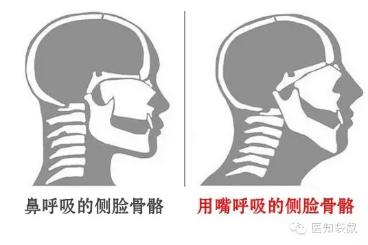 【组图】张嘴睡觉会越变越丑？看完你就知道了