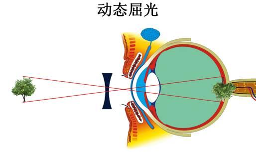 健视加云+智能眼镜，云端庞大数据库下的科学矫正原理