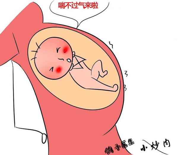 j2开奖直播:【j2开奖】胎动不按常规出牌，就要警惕终止妊娠了！