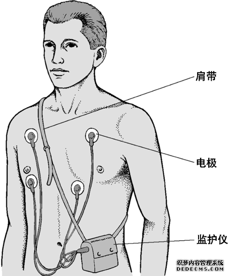 谷歌最新专利“穿戴式心电图设备