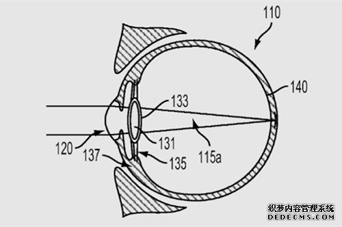 谷歌新专利电子晶状体 可治疗老花眼矫正近视