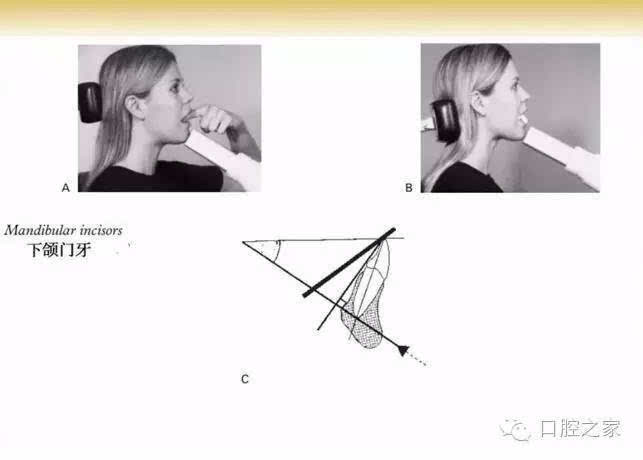 在临床操作中多人不会拍片，角度不对，整不明白，尤其是一些实习生。今天本港台直播给大家说说怎么快速学会拍牙片。