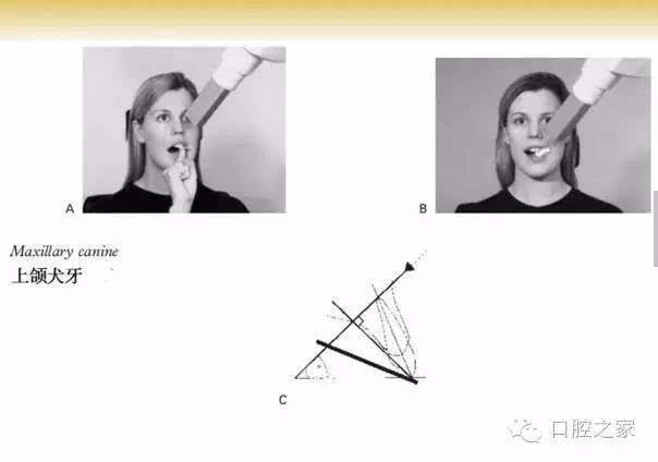 在临床操作中多人不会拍片，角度不对，整不明白，尤其是一些实习生。今天本港台直播给大家说说怎么快速学会拍牙片。