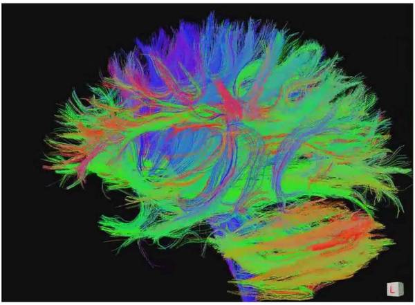 码报:【图】前沿 | 耶鲁大学人脑研究：用磁共振扫描你的智力水平