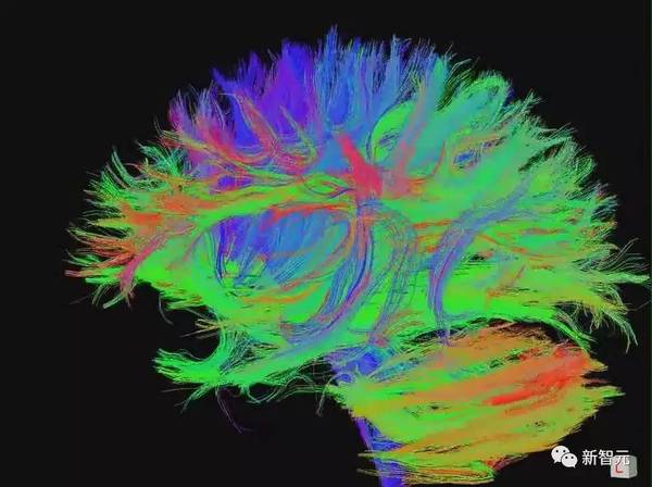 wzatv:【j2开奖】耶鲁神经科学扫描大脑判断人类智力，区分准确率达99%