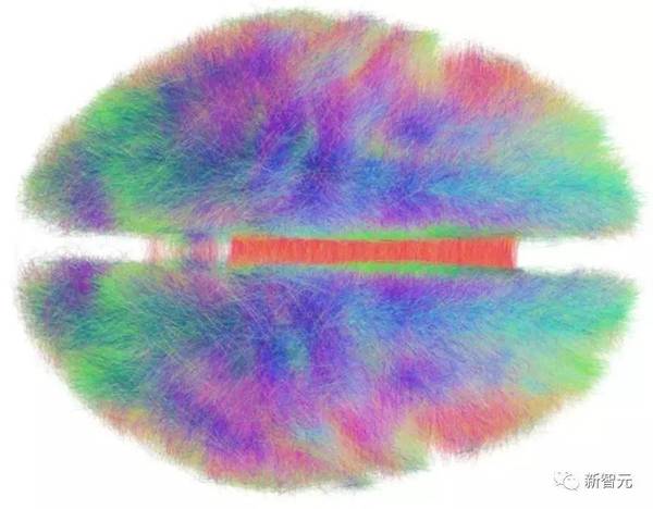 wzatv:【j2开奖】耶鲁神经科学扫描大脑判断人类智力，区分准确率达99%