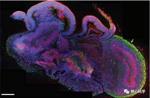 【j2开奖】培养皿中的“大脑”——慢慢增长的智慧