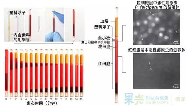 码报:【j2开奖】你小时候玩过这种小玩具吗？现在，科学家要用它救人了