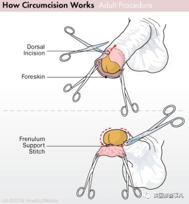 报码:【j2开奖】这家卖人皮的公司，丧心病狂把割下的包皮加工卖到全球，却受到美国人追捧
