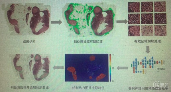 wzatv:【j2开奖】【钛坦白】DeepCare刘圣：人工智能在病理领域的算法实现和产品化思路