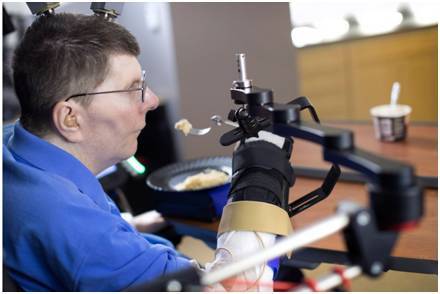 码报:【图】瘫痪患者借助神经假体，首次实现手臂的移动