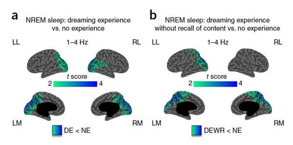 wzatv:【j2开奖】怎样的大脑活动算做梦？|Nature Neuroscience论文