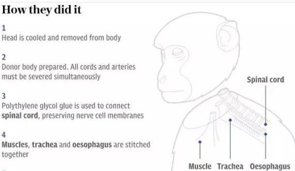 wzatv:【j2开奖】全球首例人类换头术倒计时，看了猴子和双头鼠实验感觉要“呵呵”