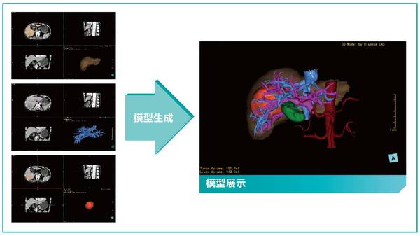 报码:【j2开奖】手术方案可以用AI全程设计了，科幻离现实还有多远？