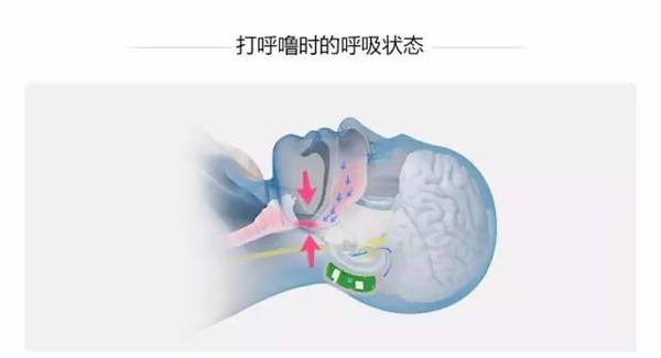 报码:【j2开奖】你的床上生活因为它而饱受折磨，现在有一种方法可以拯救你