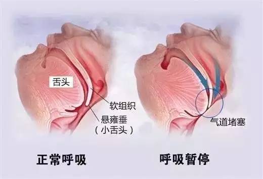 报码:【j2开奖】你的床上生活因为它而饱受折磨，现在有一种方法可以拯救你