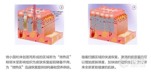 wzatv:专属的私人美容医生，易科美护肤美容仪体验