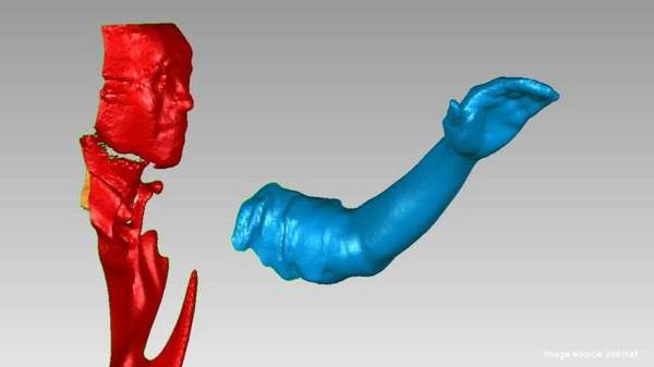 wzatv:3D打印已经可以打印器官了？起码帮到了一只鸟！