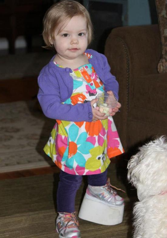 今年4岁的Elsie Moravek来自美国密歇根州，她出生时患有股骨近端部分骨骼缺损，由于髋关节不稳定，左肢畸形比她的右腿短了约11cm。